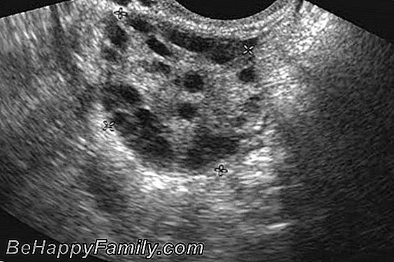 Ultrasonidos a realizar durante el embarazo mes a mes
