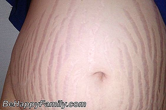 Soins de la peau pendant la grossesse