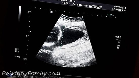 Bulan ketiga kehamilan