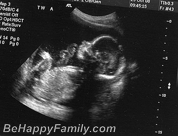 Ultrasounds akan dilakukan semasa bulan kehamilan mengikut bulan