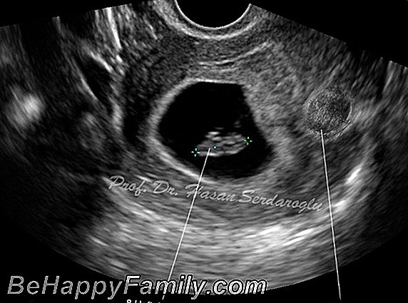 Womb Tube: Hamilelik testi Youtube'da canlı