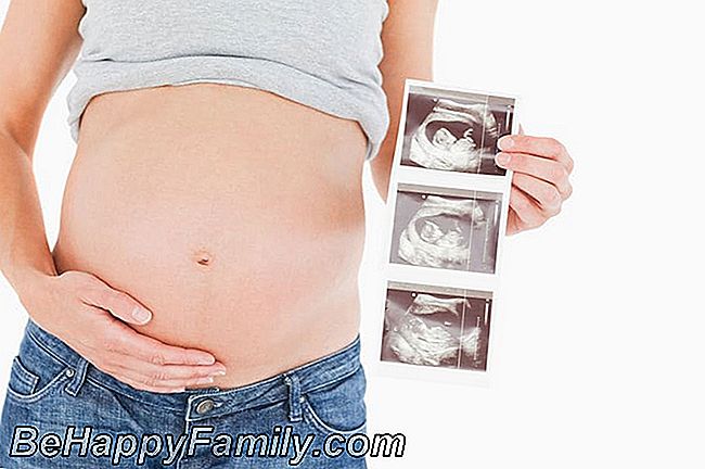 Embarazo no planificado: las primeras cosas que hacer
